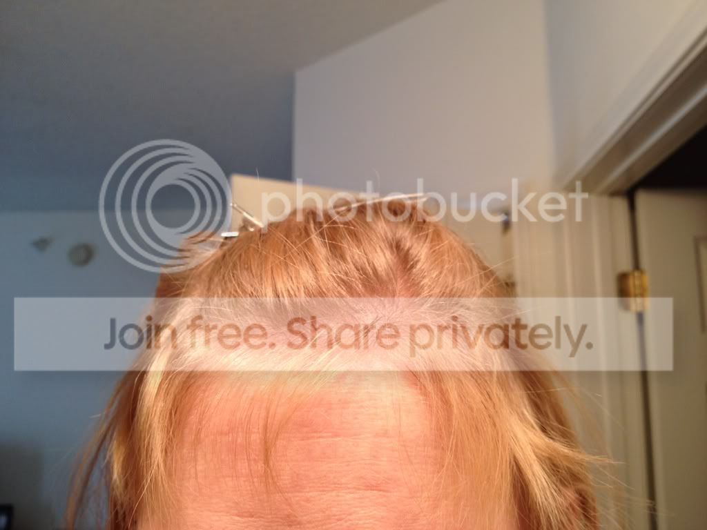 Ugh Baby Bangs After Pp Hair Loss Pic Babycenter